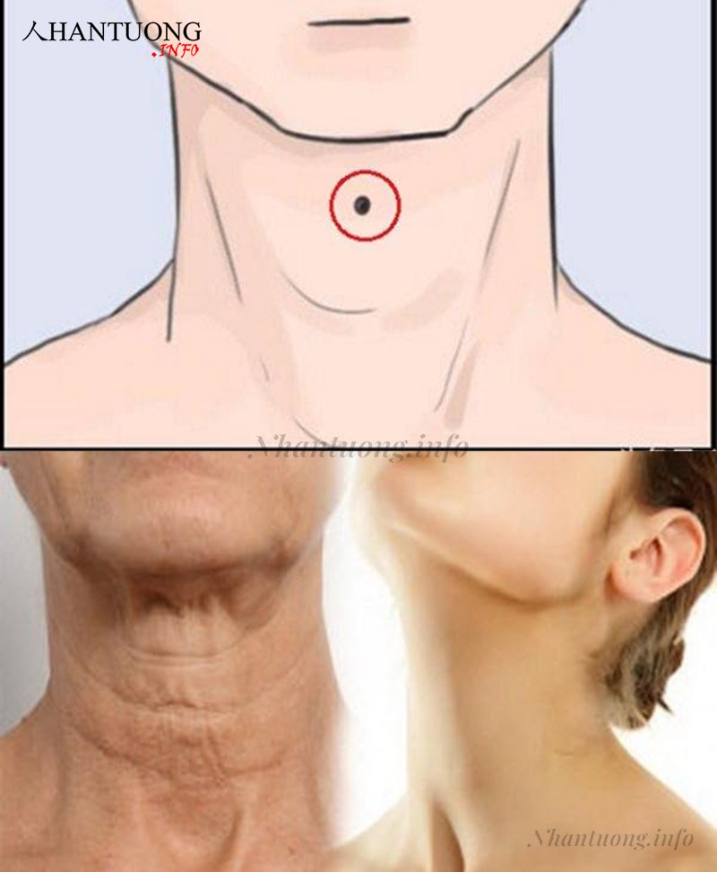 Trên cổ có nốt ruồi hoặc nếp nhăn ngang Trên cổ có nốt ruồi hoặc nếp nhăn ngang