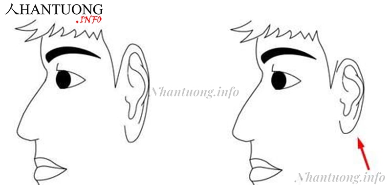 Tai thấp hơn lông mày (hình phải) Tai thấp hơn lông mày (hình phải)