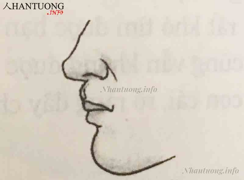 Nhân trung hình trăng lưỡi liềm Nhân trung hình trăng lưỡi liềm