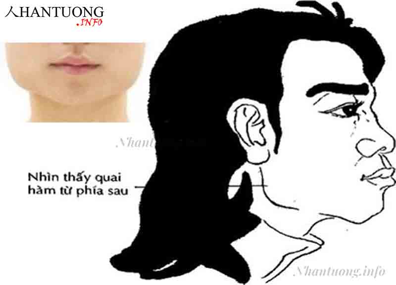 Xương quai hàm bạnh rộng, nhô về phía tai Xương quai hàm bạnh rộng, nhô về phía tai