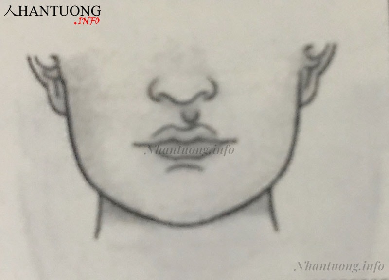 Nhân trung nghiêng lệch Nhân trung nghiêng lệch