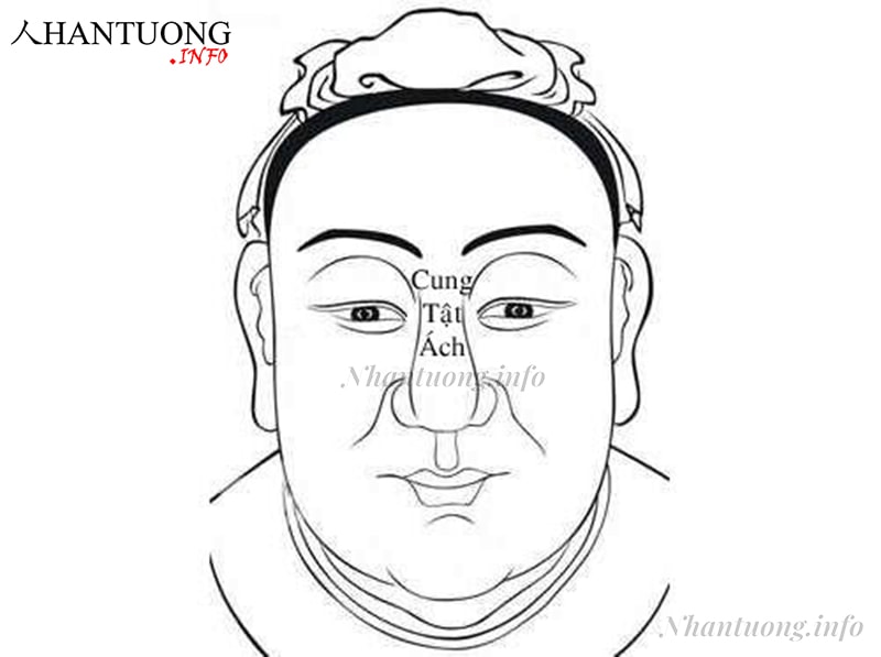 Cung tật ách Cung tật ách
