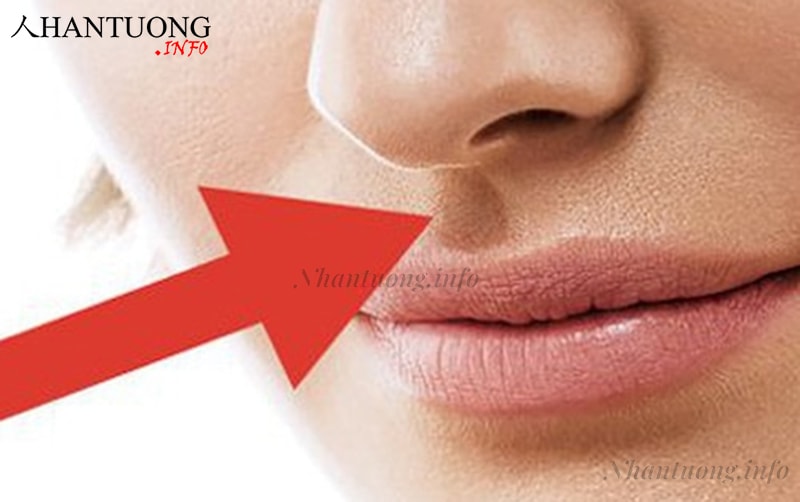 Nhân trung nông, ngắn Nhân trung nông, ngắn