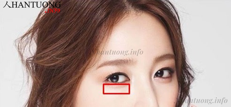 Vị trí lệ đường trên khuôn mặt Vị trí lệ đường trên khuôn mặt