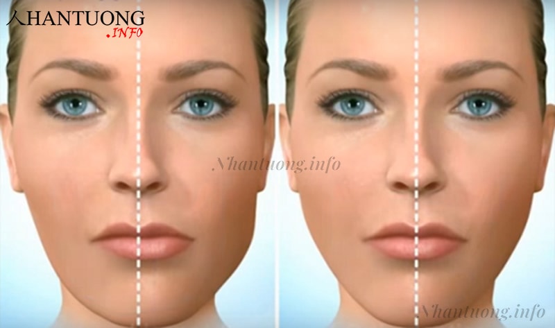Miệng lệch (hình trái) Miệng lệch (hình trái)