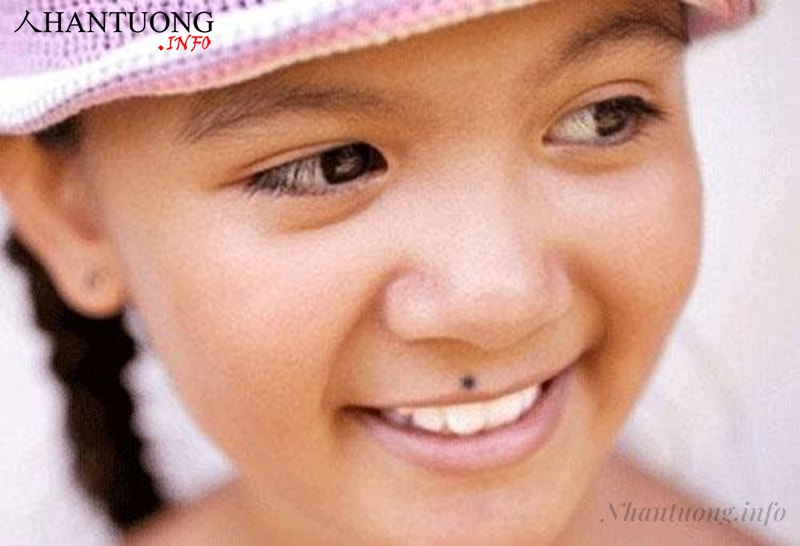 Nhân trung có nốt ruồi Nhân trung có nốt ruồi