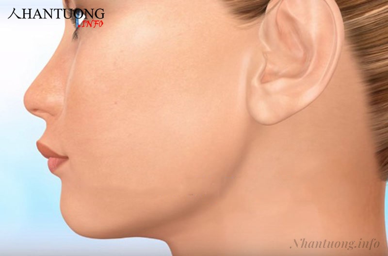Tướng môi nhọn Tướng môi nhọn