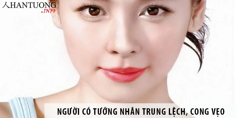 Tướng nhân trung lệch, cong vẹo báo hiệu gì về cuộc đời của bạn? Tướng nhân trung lệch, cong vẹo báo hiệu gì về cuộc đời của bạn?