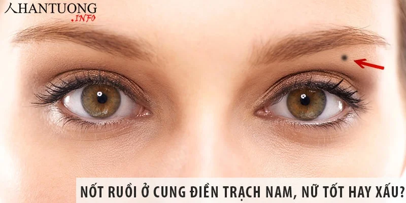Nốt ruồi ở cung điền trạch nam, nữ tốt hay xấu? Nốt ruồi ở cung điền trạch nam, nữ tốt hay xấu?