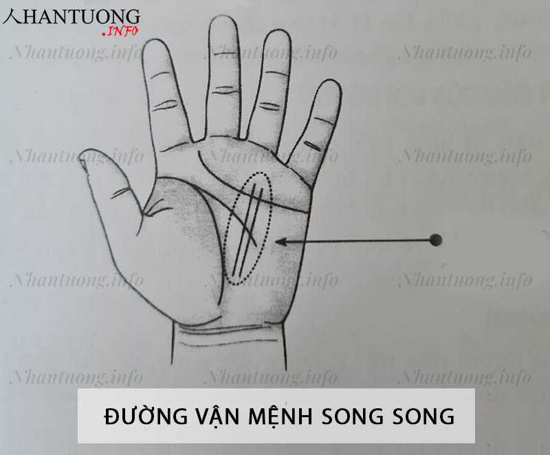 Đường vận mệnh song song Đường vận mệnh song song