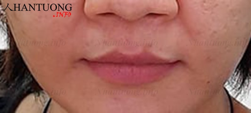 Phụ nữ có tướng miệng củ ấu (môi sừng trâu) Phụ nữ có tướng miệng củ ấu (môi sừng trâu)