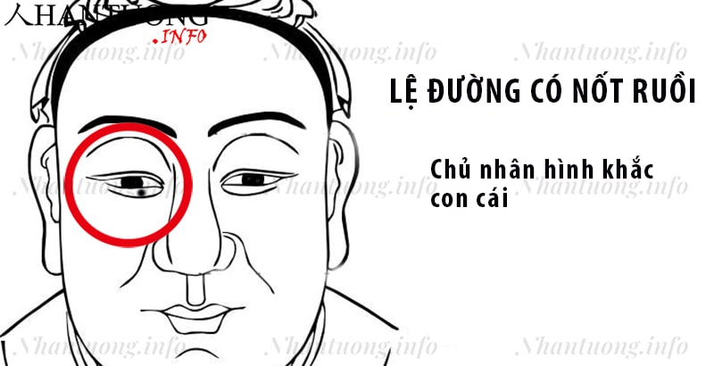 Nốt ruồi ở lệ đường - Hình khắc con cái Nốt ruồi ở lệ đường - Hình khắc con cái