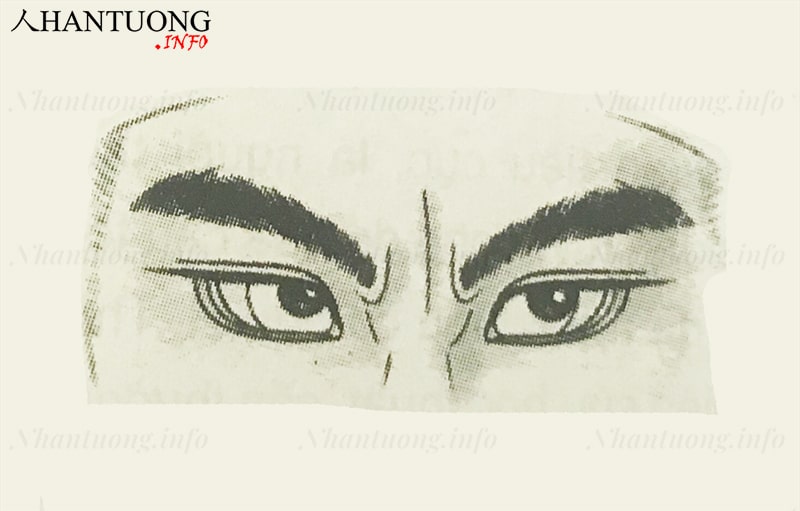 Nếp nhăn giữa 2 chân mày hình kim treo (luyến chân văn) Nếp nhăn giữa 2 chân mày hình kim treo (luyến chân văn)