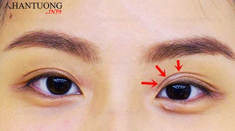 Cách xác định tướng mắt 3 mí Cách xác định tướng mắt 3 mí