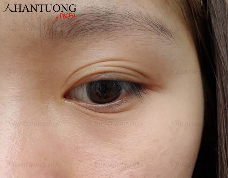 Tướng mắt nhiều mí Tướng mắt nhiều mí
