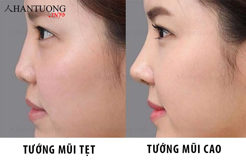 Cách phân biệt tướng mũi tẹt và mũi cao Cách phân biệt tướng mũi tẹt và mũi cao