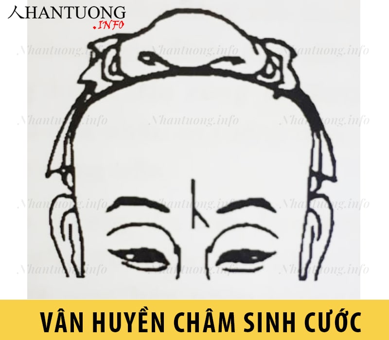 Vân huyền châm sinh cước Vân huyền châm sinh cước