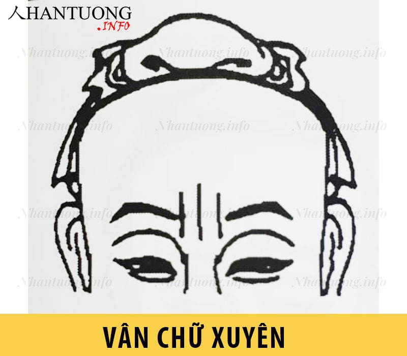 Vân chữ xuyên – 3 nếp nhăn thẳng Vân chữ xuyên – 3 nếp nhăn thẳng