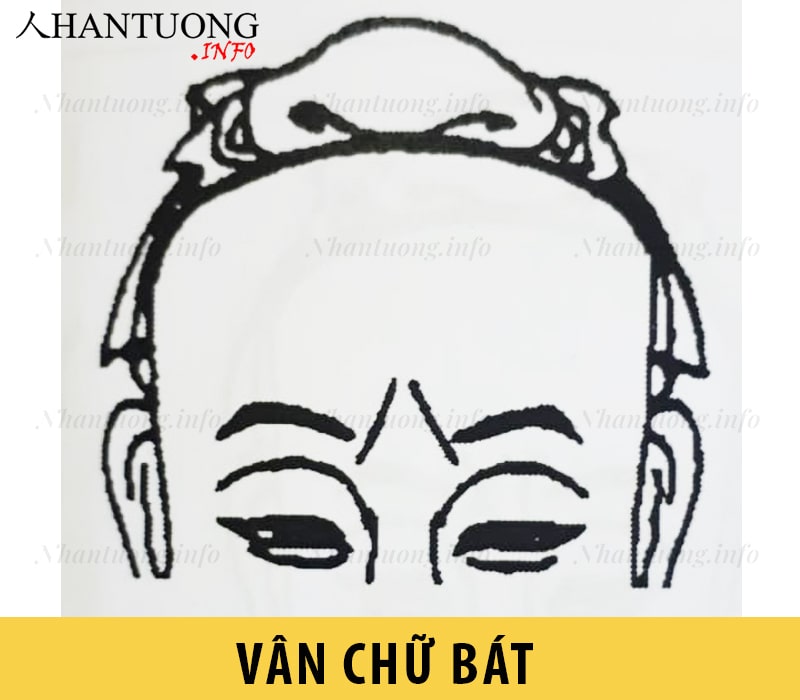 Vân chữ bát – nếp nhăn dấu huyền Vân chữ bát – nếp nhăn dấu huyền