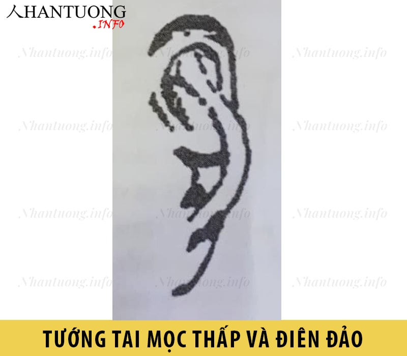 Hình dáng tướng tai mọc thấp và điên đảo Hình dáng tướng tai mọc thấp và điên đảo