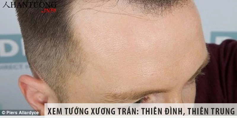Xem tướng xương trán: Thiên đình, thiên trung, tư không, trung chính Xem tướng xương trán: Thiên đình, thiên trung, tư không, trung chính