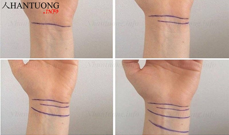 Ý nghĩa từng đường ngấn trên cổ tay Ý nghĩa từng đường ngấn trên cổ tay