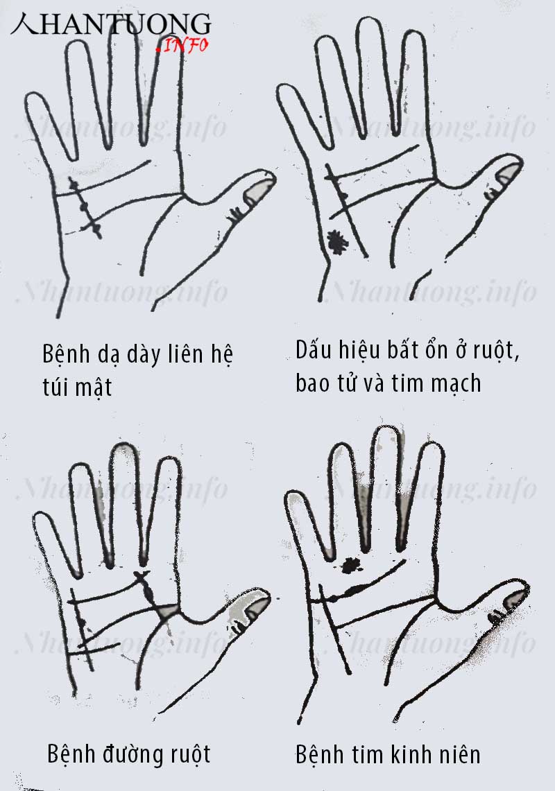 Xem đường thủy tinh đoán biết bệnh tật 1 Xem đường thủy tinh đoán biết bệnh tật 1