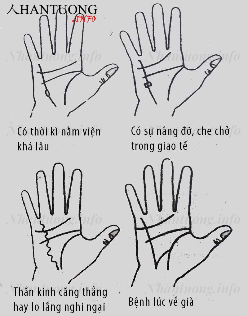 Xem đường thủy tinh đoán biết bệnh tật 2 Xem đường thủy tinh đoán biết bệnh tật 2