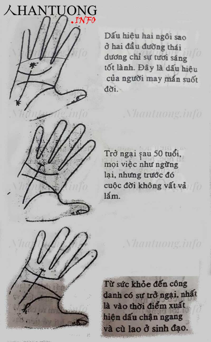 Xem đường Thái dương - đường chỉ tay thành công trên bàn tay 14 Xem đường Thái dương - đường chỉ tay thành công trên bàn tay