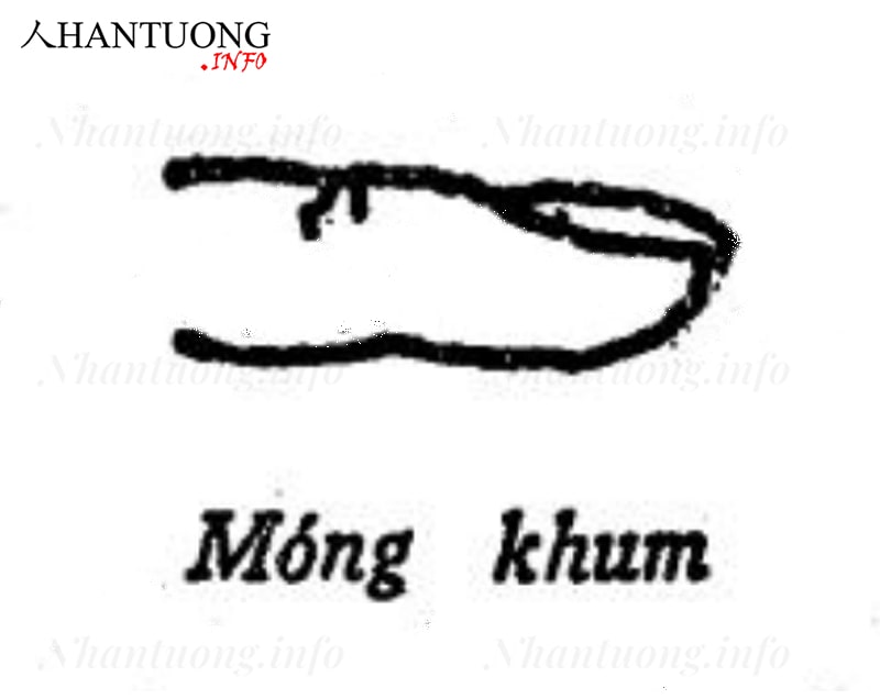 Tướng móng tay khum Tướng móng tay khum