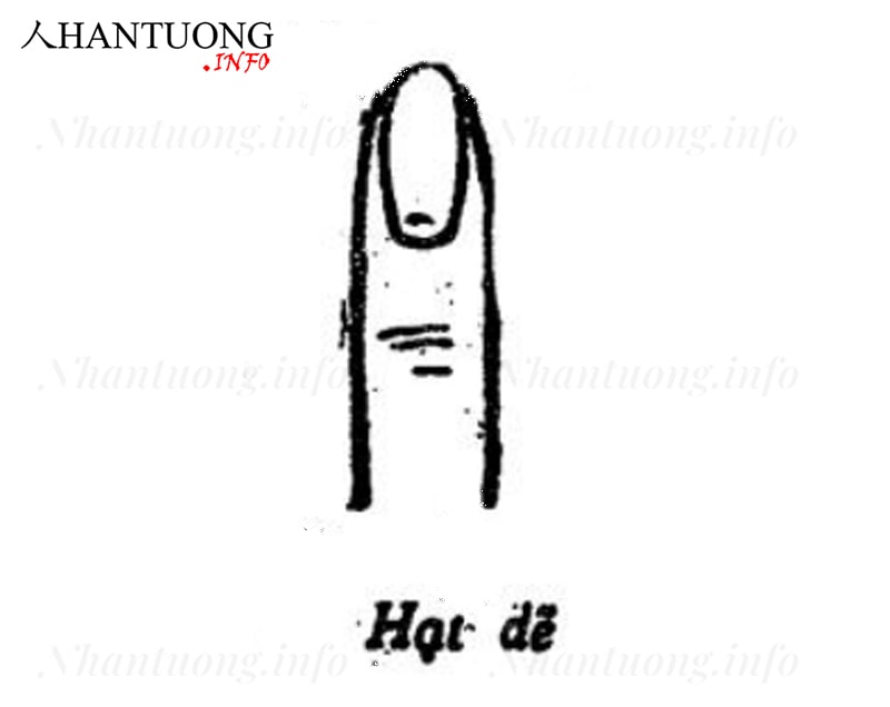 Tướng móng tay hạt dẻ Tướng móng tay hạt dẻ