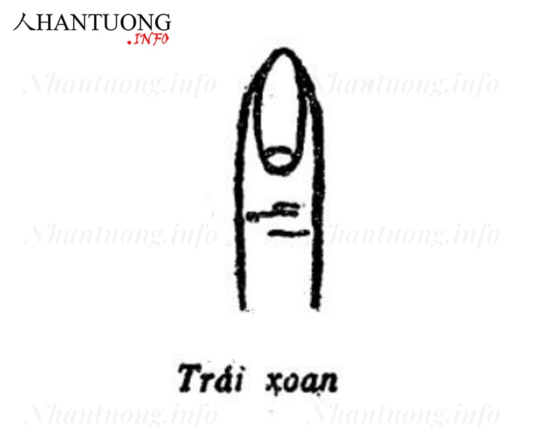 Tướng móng hình trái xoan Tướng móng hình trái xoan
