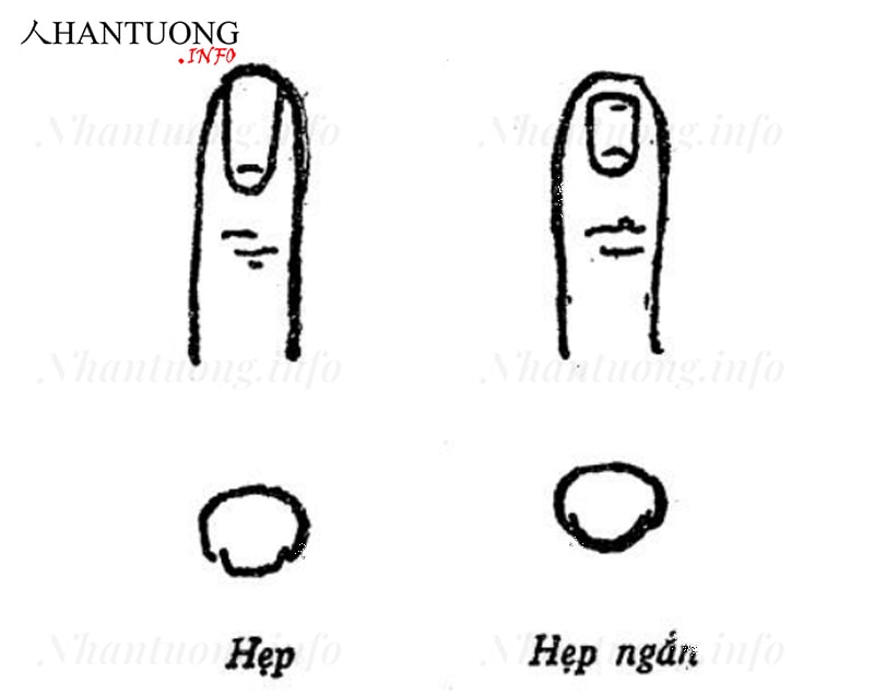 Tướng móng tay hẹp Tướng móng tay hẹp