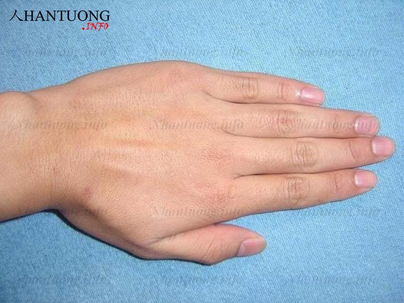 Các ngón tay khít nhau, không có kẽ hở Các ngón tay khít nhau, không có kẽ hở
