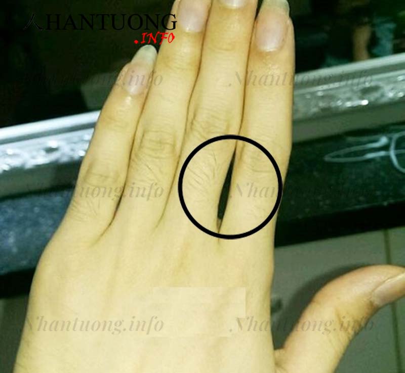 Khe hở giữa ngón trỏ và ngón giữa Khe hở giữa ngón trỏ và ngón giữa