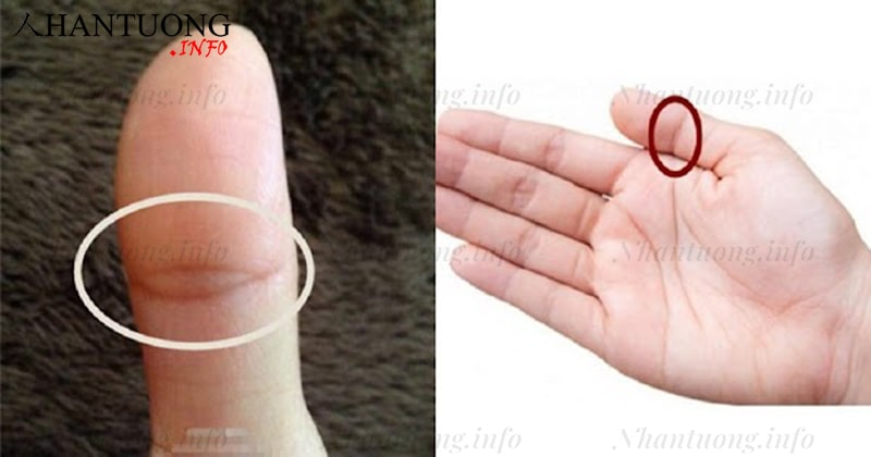 Ngón cái có vân mắt phượng Ngón cái có vân mắt phượng