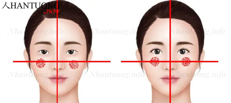 Cách xác định xương gò má cao gò má thấp Cách xác định xương gò má cao gò má thấp