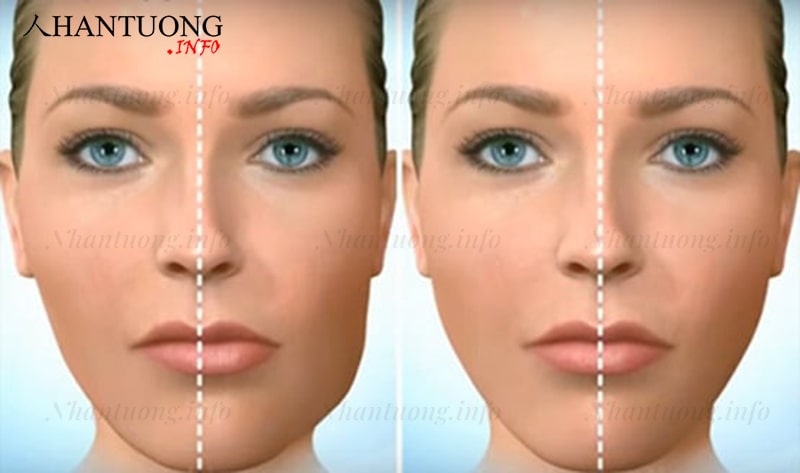 Cách xác định cằm bị lệch Cách xác định cằm bị lệch