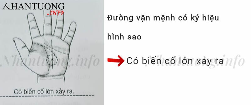 Đường vận mệnh có ký hiệu hình sao Đường vận mệnh có ký hiệu hình sao