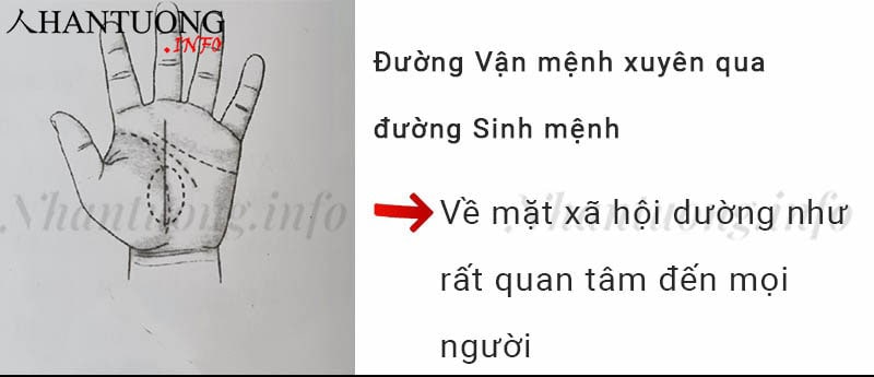 Đường Vận mệnh xuyên qua đường Sinh mệnh Đường Vận mệnh xuyên qua đường Sinh mệnh
