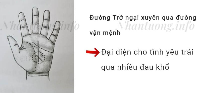 Đường Trở ngại xuyên qua đường vận mệnh Đường Trở ngại xuyên qua đường vận mệnh