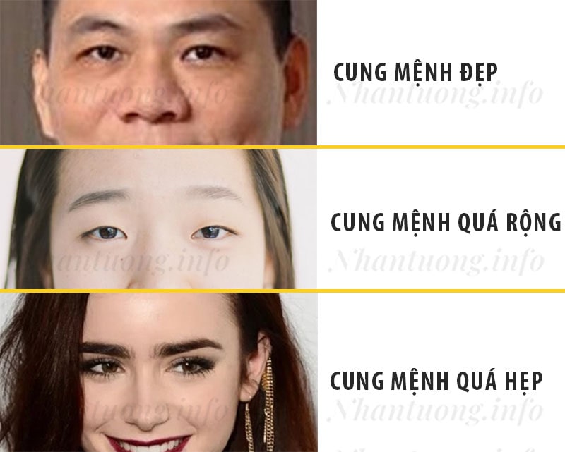 Các tướng lý cung Mệnh thường gặp Các tướng lý cung Mệnh thường gặp