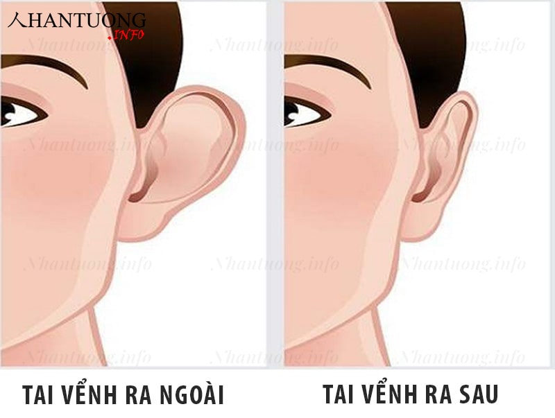 Nhận biết tướng tai vểnh ra ngoài Nhận biết tướng tai vểnh ra ngoài