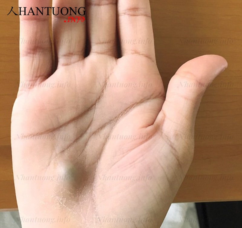 Đường trí tuệ khởi đầu trùng với đường sinh mệnh Đường trí tuệ khởi đầu trùng với đường sinh mệnh
