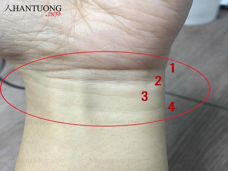 Đường cổ tay 3 ngấn gồm 4 kẻ vạch Đường cổ tay 3 ngấn gồm 4 kẻ vạch