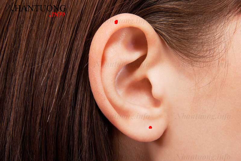 Nốt ruồi ở tai Nốt ruồi ở tai