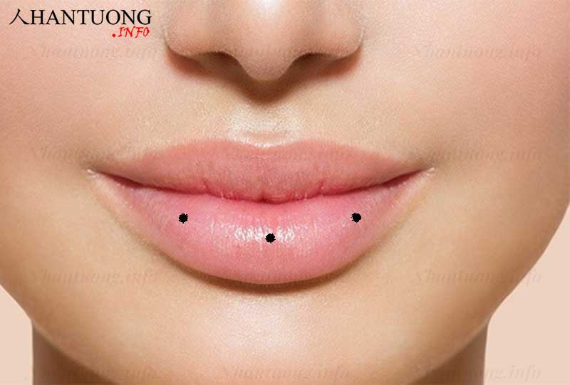 Nốt ruồi mọc ở môi dưới Nốt ruồi mọc ở môi dưới