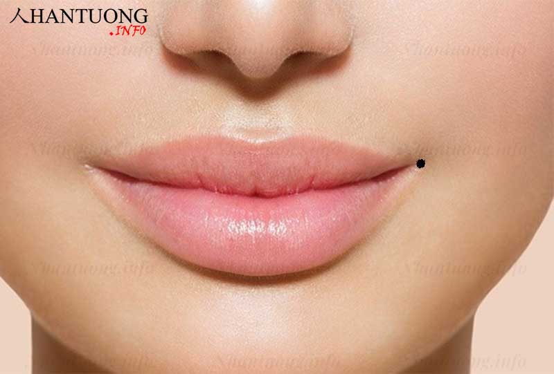 Nốt ruồi ở khóe miệng bên trái Nốt ruồi ở khóe miệng bên trái