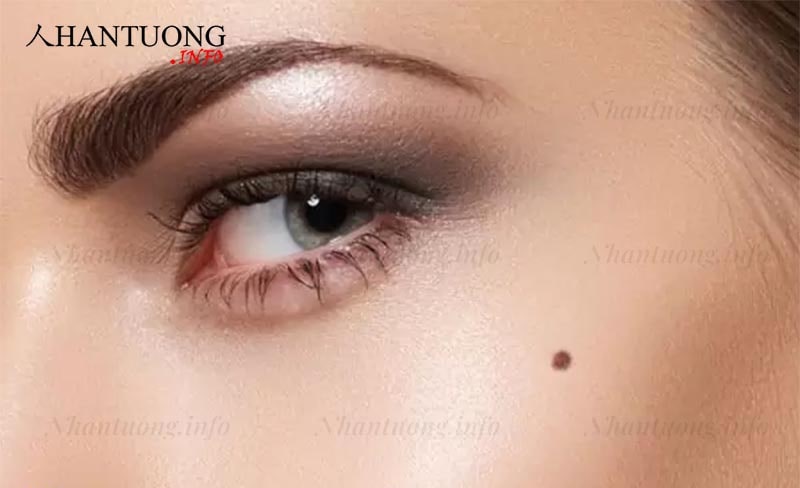 Nốt ruồi trên gò má Nốt ruồi trên gò má