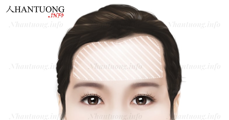 Đặc điểm tướng trán lệch Đặc điểm tướng trán lệch